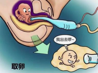 2022广州不孕不育医院排名，助孕成功率前十名参考