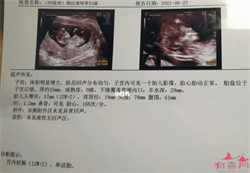 郑州失独助孕,做郑州助孕试管婴儿准好好这些手续后的助孕流程