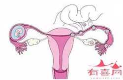 杭州职业代生,警惕现代生活方式导致不孕症